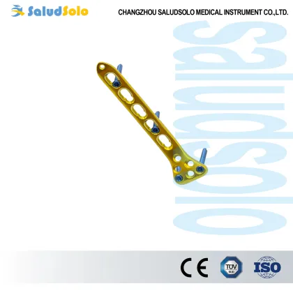 Proximal Radius Locking Plate