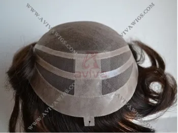 Hair Replacement (AV-TP017)