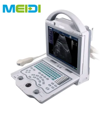 Full Digital B Mode Ultrasound Scanner