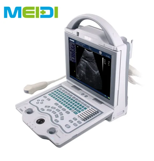 Full Digital B Mode Ultrasound Scanner