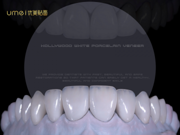 Refractory Veneers