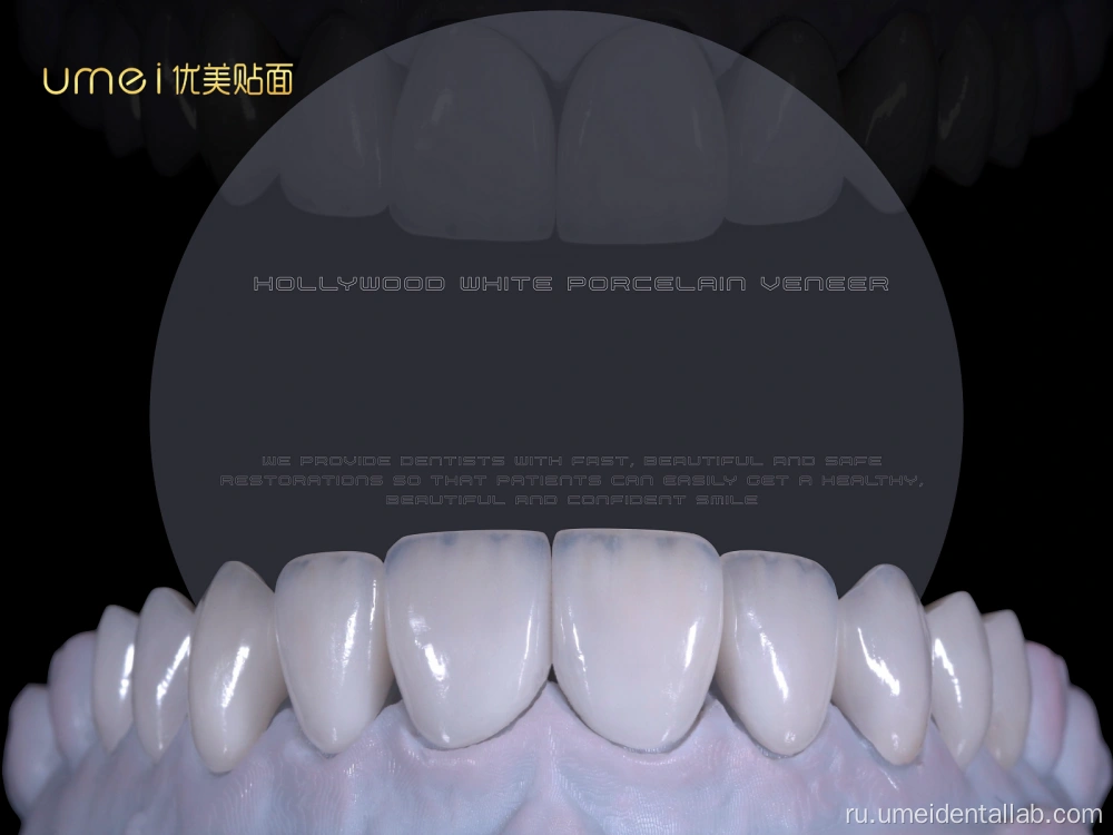 Dental Restoration Showcase