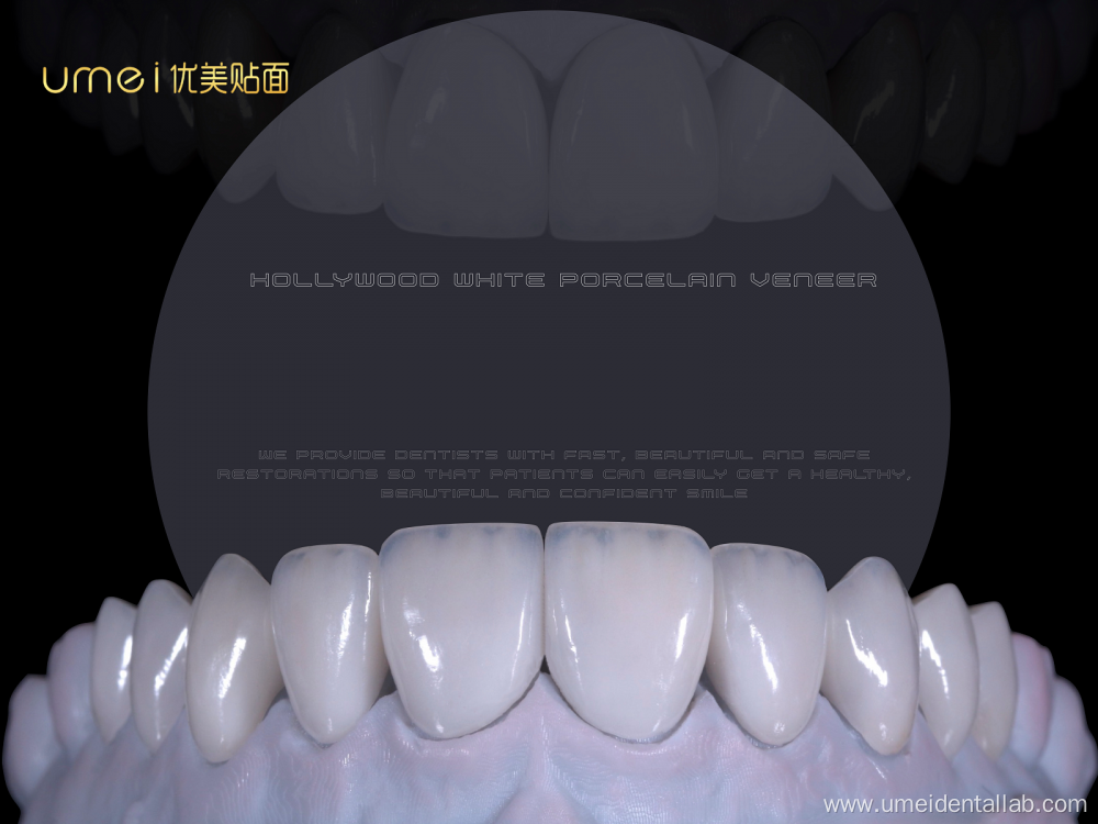 Refractory Veneers