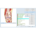 body health nonlinear nls scanner