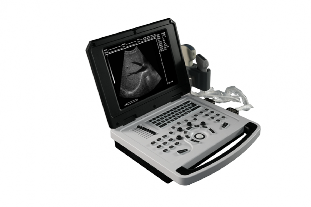 Notebook Escáner de ultrasonido en blanco y negro para ginecología