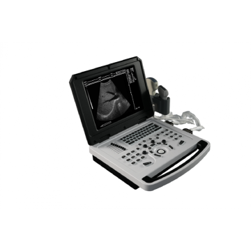 Notebook Scanner ad ultrasuoni in bianco e nero per ginecologia