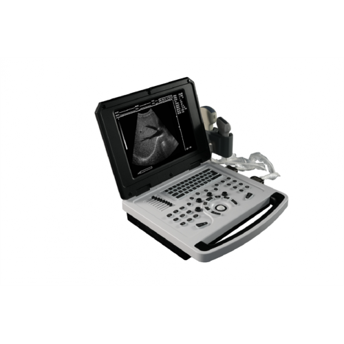 Notebook Ultrasound Scanner Notebook Black and White Ultrasound Scanner for Gynecology Manufactory