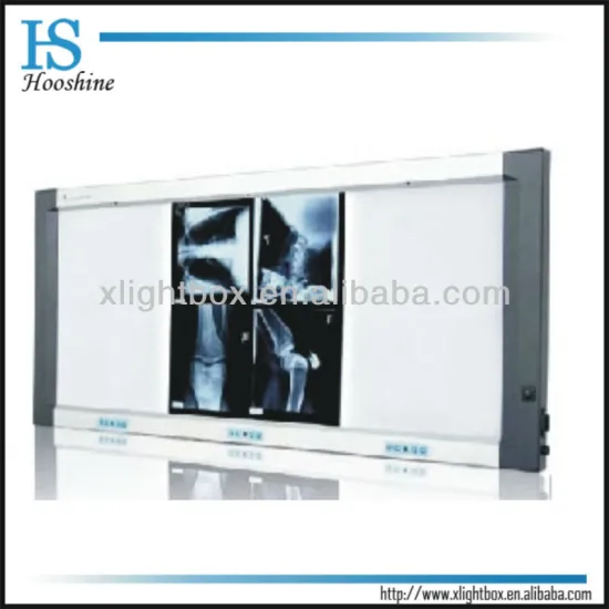 Four Bank Radiology Illuminator/self-induction