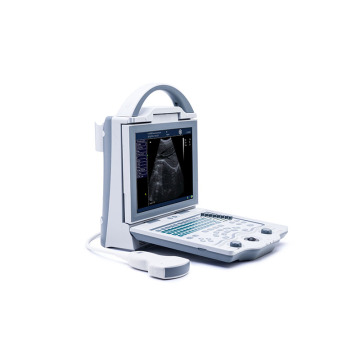 MEIDI B Mode Ophthalmological Ultrasound Scanner Ultrasonic Electronic Equipment Machine