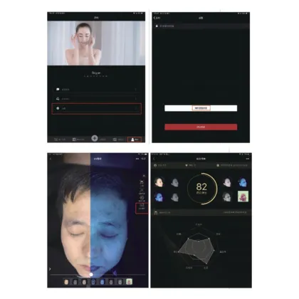 Home Use Skin Analyzer Machine - Facial Skin Analyser Scanner