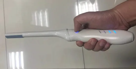 Sonostar Wireless Veterinary Ultrasound Equipment