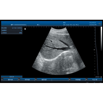 SS-100 Portable Ultrasound Probe