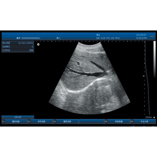 SS-100 Portable Ultrasound Probe