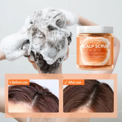 Anti Dandruff Scalp Scrub Shampoo with Exfoliating Hair Massage