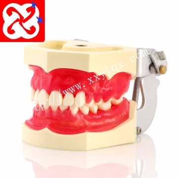 Model Praktek Penyakit Periodontal: Demonstrasi Kalkulus dan Gingivitis