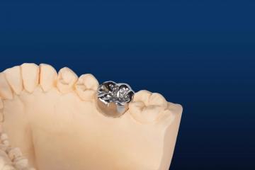 Kid's Stainless Steel Dental Crown Protector