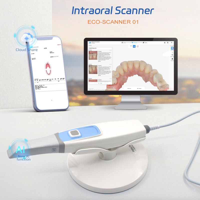 Dental Intraoral Scanner