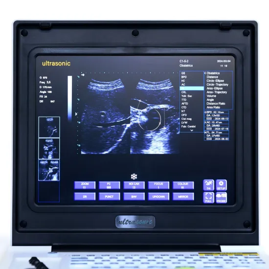 Male cirrhosis ultrasound diagnostic instrument