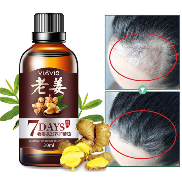 7 Days Hair Growth Hair Loss Treatment Essential Oil Herbal Ginger Liquid Anti Hair Loss Dense Hairs Root Repair Hair Care TSLM1