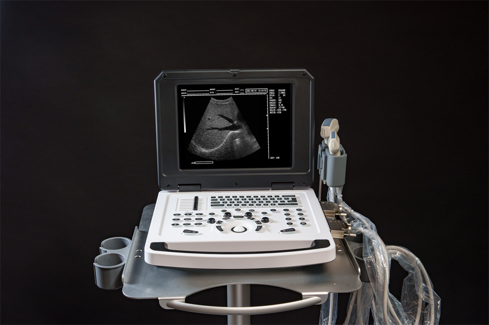 Full Digital Laptop Ultrasound Scanner Pregnancy ultrasound scanner