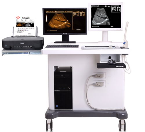 Mesin Ultrasound Trolley 3D medis dengan Workstation