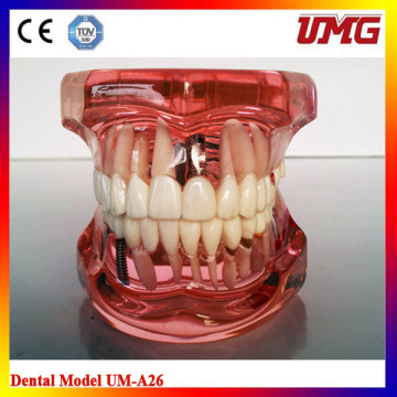 China Dental Instrument Dental Education Models