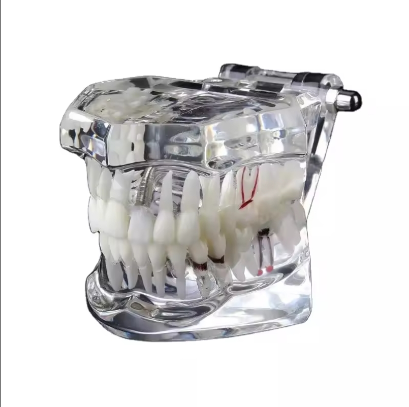 Teeth Model