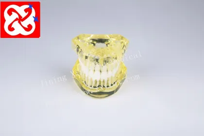 Soft Gum Model Light Color Removable Dental Teeth Demonstration