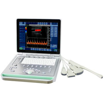 Máquina portátil do ultrassom do portátil para a clínica