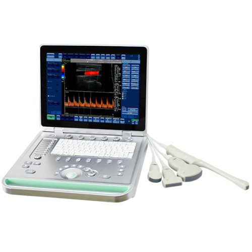 Portable laptop ultrasound machine For Clinic