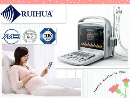 Portable sonoscape ultrasound echocardiography echo machine