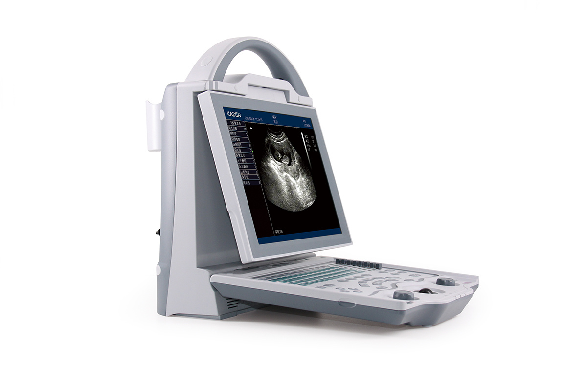 Hospital Portable Color Echographie for sales
