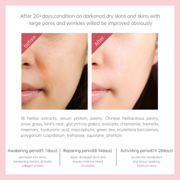 Natural Anti Aging Skin Care Set