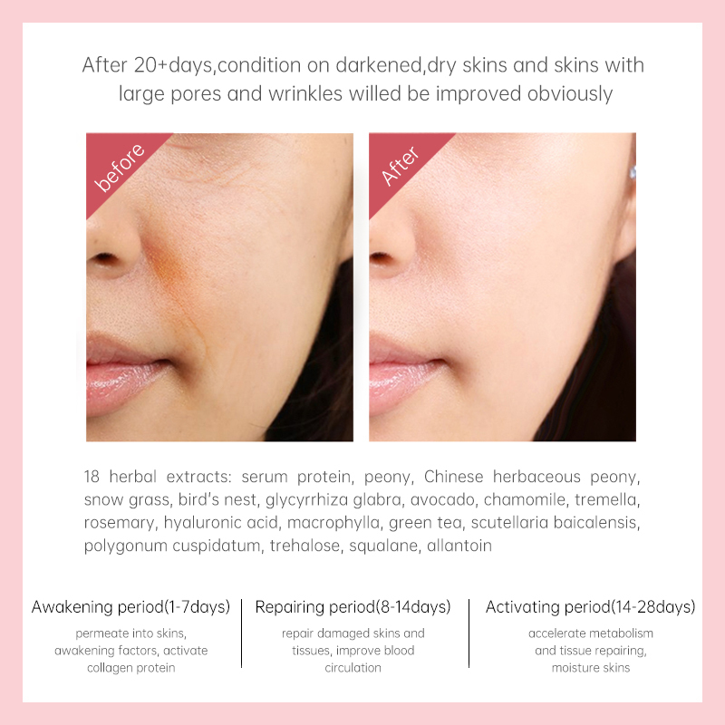 Natural Anti Aging Skin Care Set