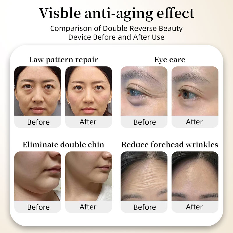 Hot Pull Ultrasonic Energy Cannon Focused Anti-Aging Instrument