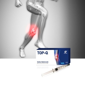 Gezamenlijke knie-injectie 1 ml hyaluronzuur natriumhyaluronaatgel