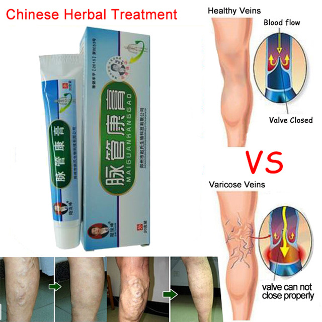 10Pcs Varicose Veins ointment vasculitis treatment Phlebitis Angiitis inflammation blood vessel Rotten legs Varicose Veins Cream
