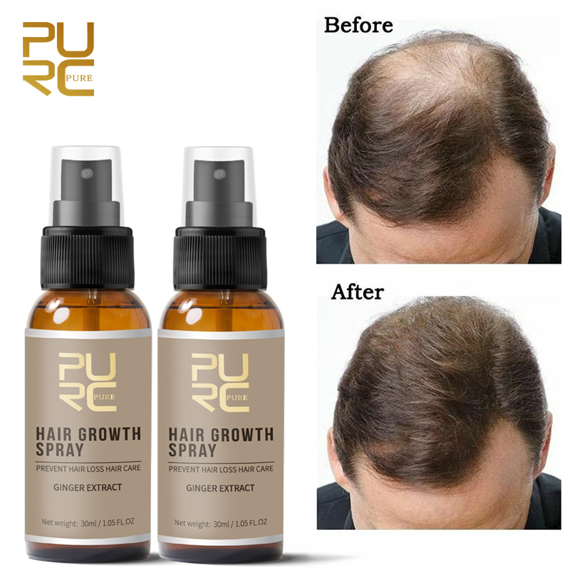 2PCS 30ml Original Anti Hair Loss Spray Enhance Hair Root Strengthen Fast Hair Growth Serum Thick & Dense Hair Care