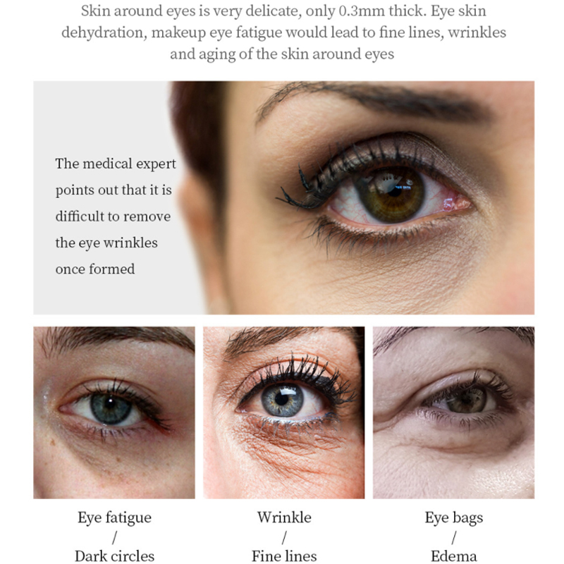 eye skincare