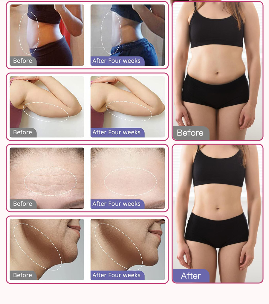 cavitation machine 9 in 1