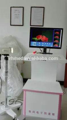 High-technology Full Digital Sony Colposcope for Sale