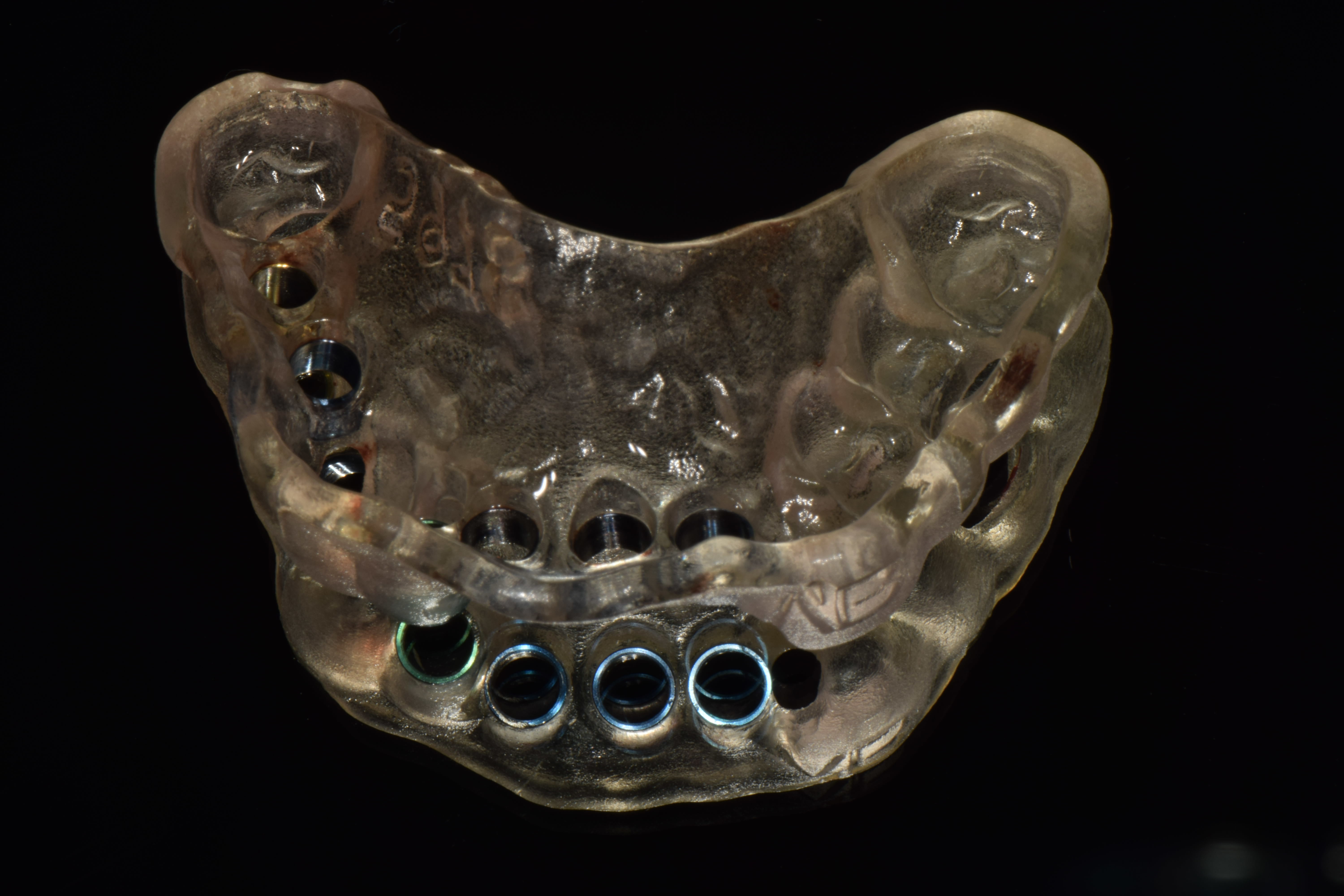 3 차원 Cad / Cam 임플란트 안내서, Bossgoo.com의 고품질 3 차원 Cad / Cam 임플란트 안내서