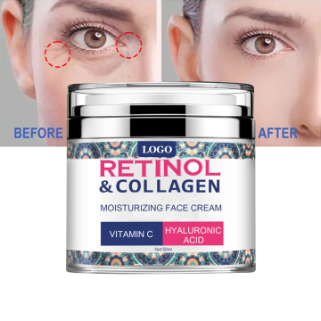 OEM Private Label Αντι-γήρανση Retinol &amp; Collagen ενυδατική κρέμα προσώπου