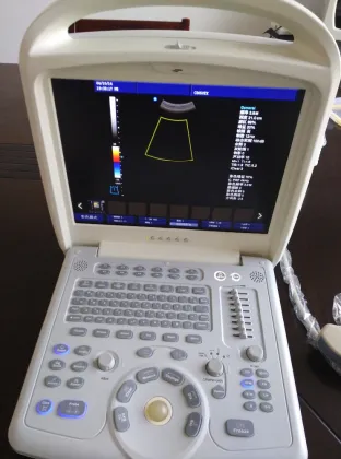 Portable sonoscape ultrasound echocardiography echo machine