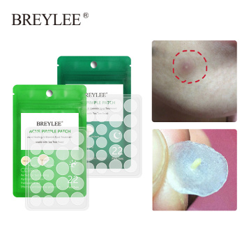 BREYLEE Acne Pimple Patch Face Sheet Mask Acne Treatment Serum Facial Acne Cream Essence Pimple Remover Tools Facial Skin Care