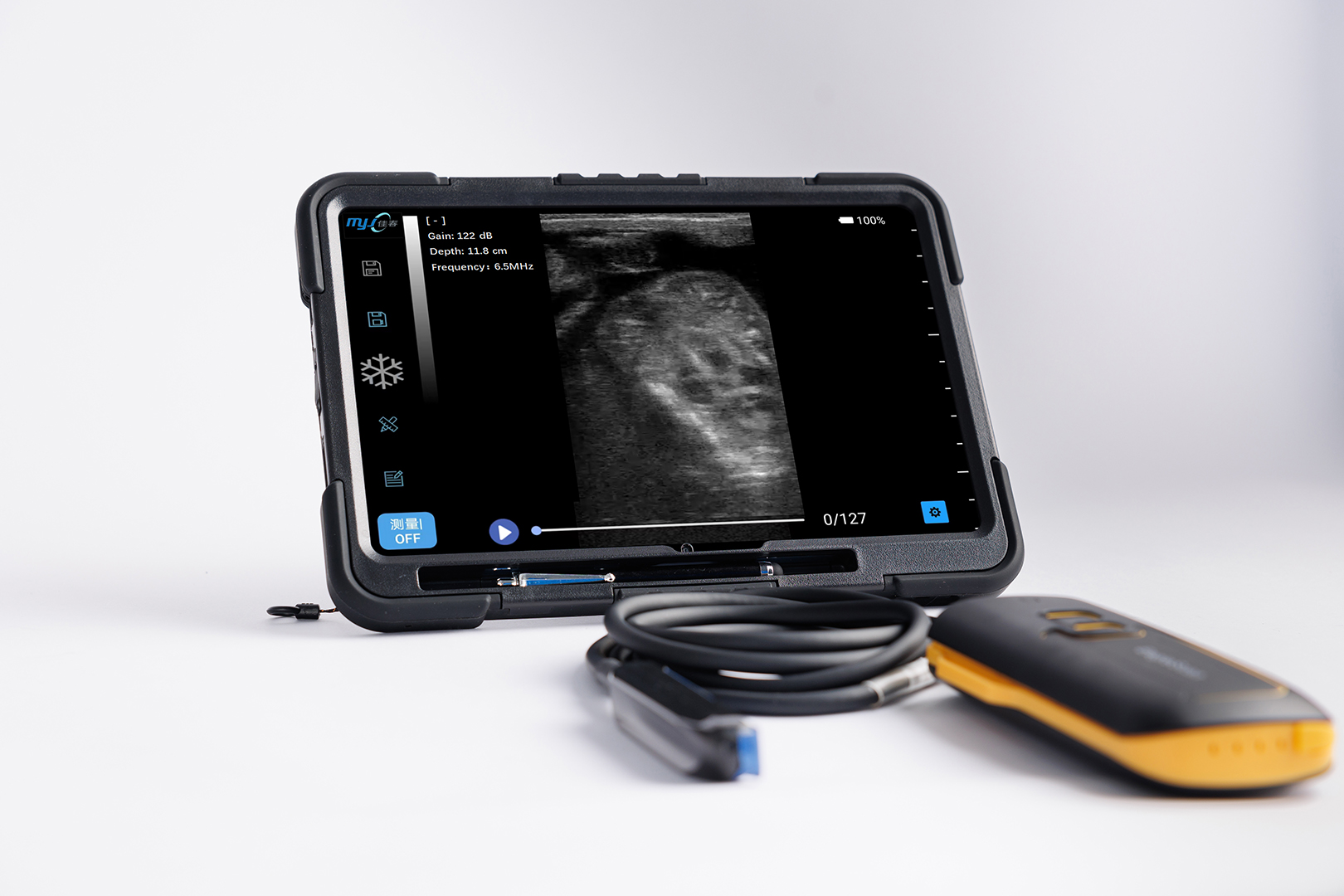 handheld wireless ultrasound