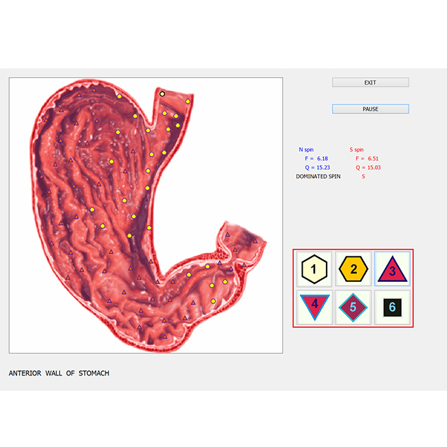 scanner de bioplasma 9d 17d íris nls