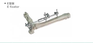 External fixator fracture fixation device