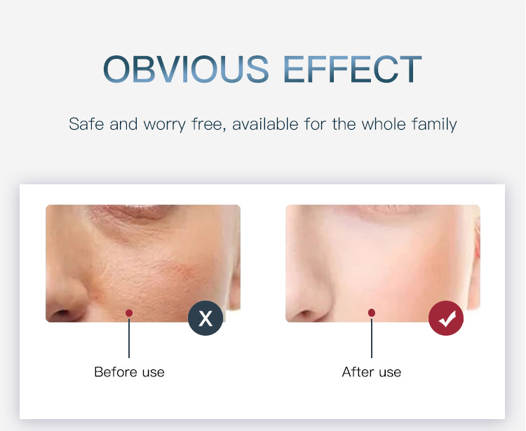 led light therapy mask