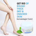 100ml Hand and feet creack urea foot cream